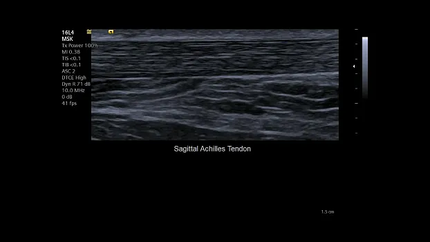 Клинические изображения Siemens Juniper УЗИ аппарат