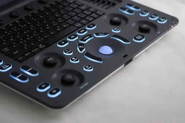 Клинические изображения Sonoscape E3 ультразвуковой аппарат