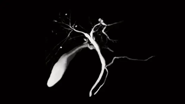 Клинические изображения МРТ аппарат Siemens Magnetom Sola 1,5T