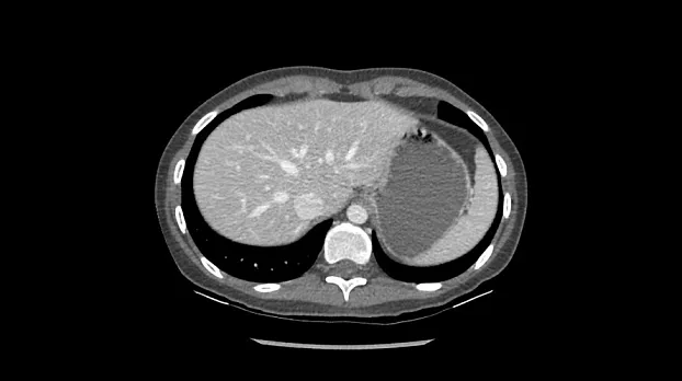 Клинические изображения Компьютерный томограф GE Discovery RT