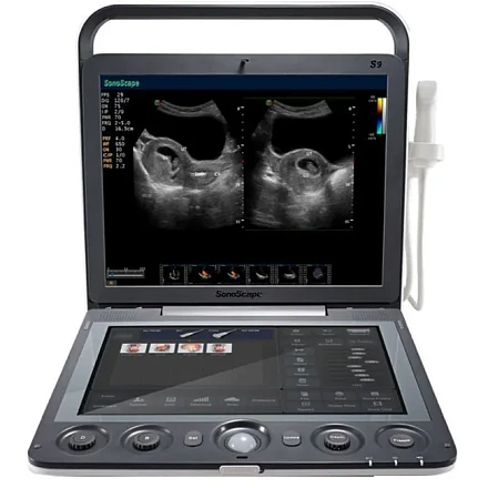 Sonoscape S9 ультразвуковой аппарат
