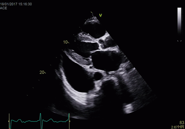 Клинические изображения УЗИ аппарат GE HealthCare Vivid E90