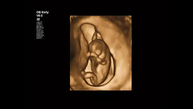 Клинические изображения Philips Affiniti 30 ультразвуковой аппарат