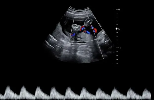 Клинические изображения УЗИ аппарат НПО СКАНЕР РУСКАН 65