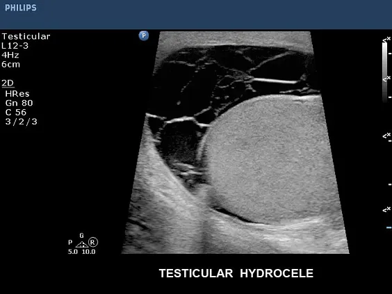 Клинические изображения Philips CX50 ультразвуковой аппарат