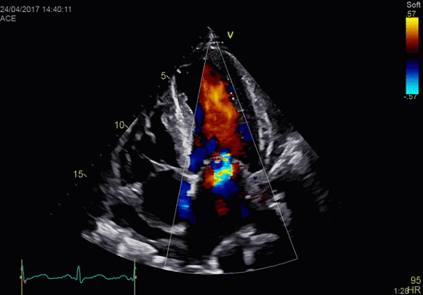 Клинические изображения УЗИ аппарат GE HealthCare Vivid E90
