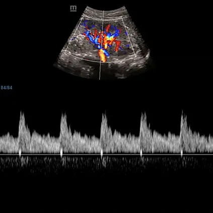 Клинические изображения УЗИ аппарат Mindray DC-40 Pro