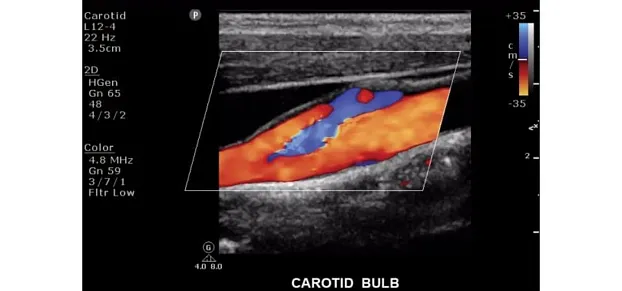 Клинические изображения Philips ClearVue 550 ультразвуковой аппарат