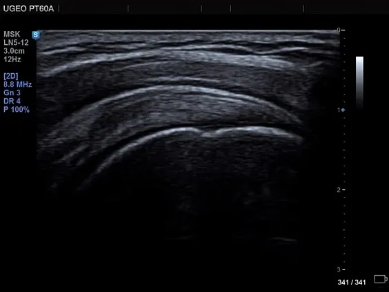 Клинические изображения Samsung Medison PT60A УЗИ аппарат